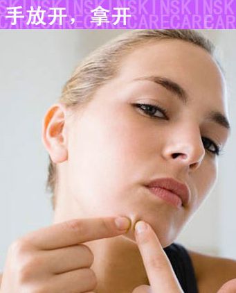 祛痘痘应该注意些什么